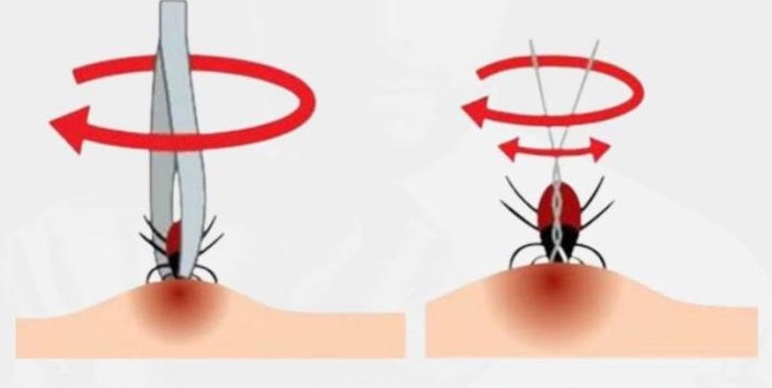 Правильно видаляємо кліща