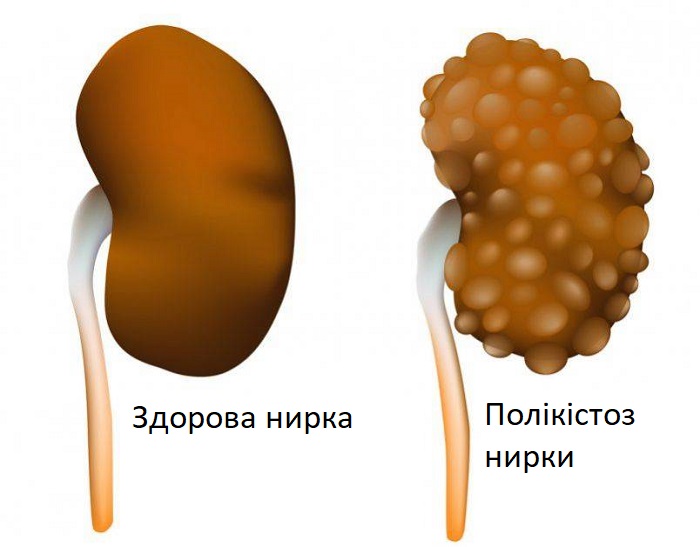Особливості полікістозу нирок у кішок