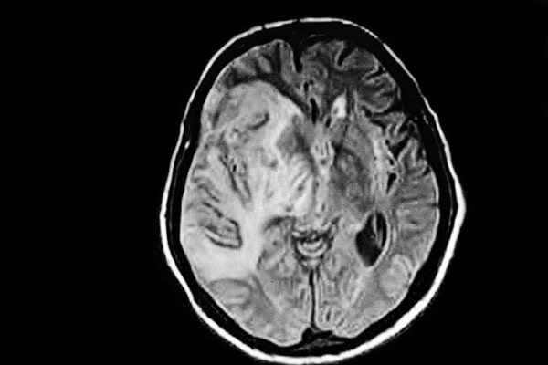 Який вигляд має мозок кішки