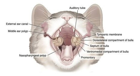 Схематичне зображення поліпів