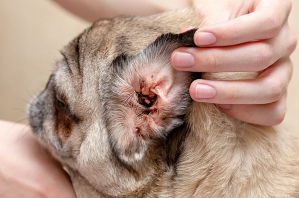 Дріжджові інфекції