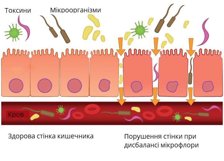Здорова та порушена мікрофлора кишечника